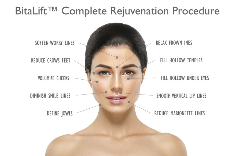 BitaLift™ Complete Rejuvenation Procedure